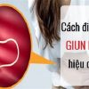 Cách chữa giun kim dân gian tại nhà an toàn và hiệu quả